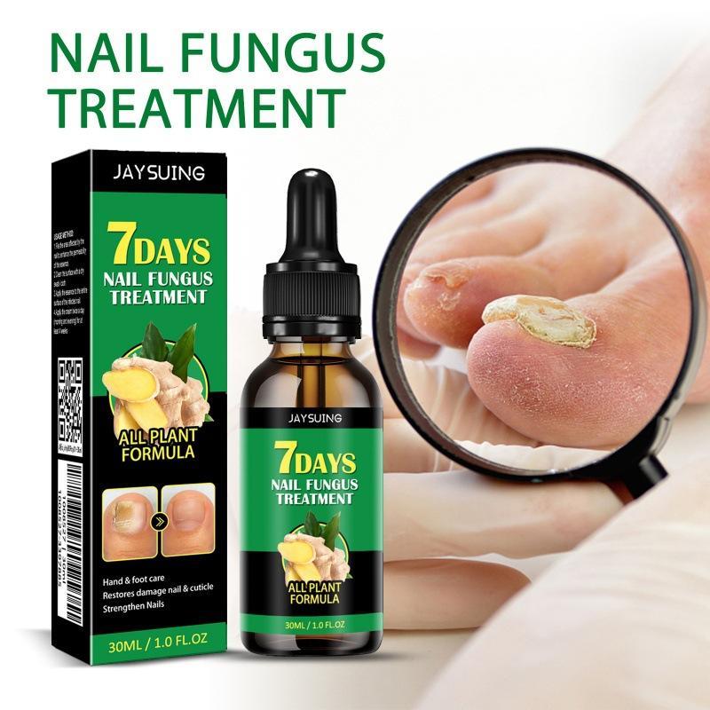 Ginger Nail Treatment NailSupport Nail Care nail support - Repair and StrengthenforClowing, Beautiful Nails