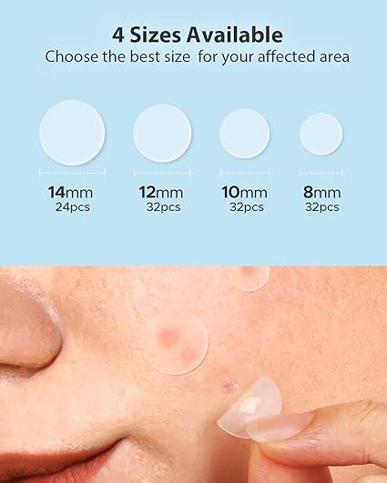 LitBear Acne Pimple Patches, Day and Night 4 Sizes 180 Dots Thin & Thick Hydrocolloid Patches with Witch Hazel, Tea Tree & Calendula Oil, Extra Adhesion for Face Zit Patch Dots Skincare Skin Repair Skincare Skin Repair Skincare Skin Repair