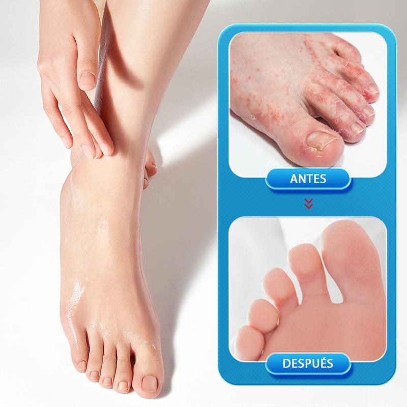 HEALMUSZ Antibacterial Care Foot Cream - Antifungal Skin Treatment for Itching, Burning and Cracking