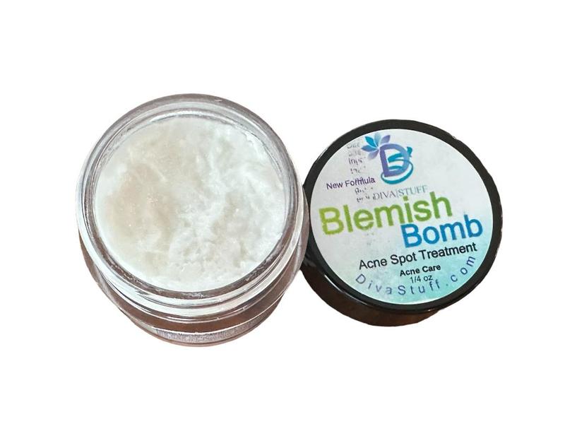 Diva Stuff Best Blemish Bomb Spot Treatment, Anti-acne spot treatment cream for Men and Women, 1 4 oz (Made in the USA)