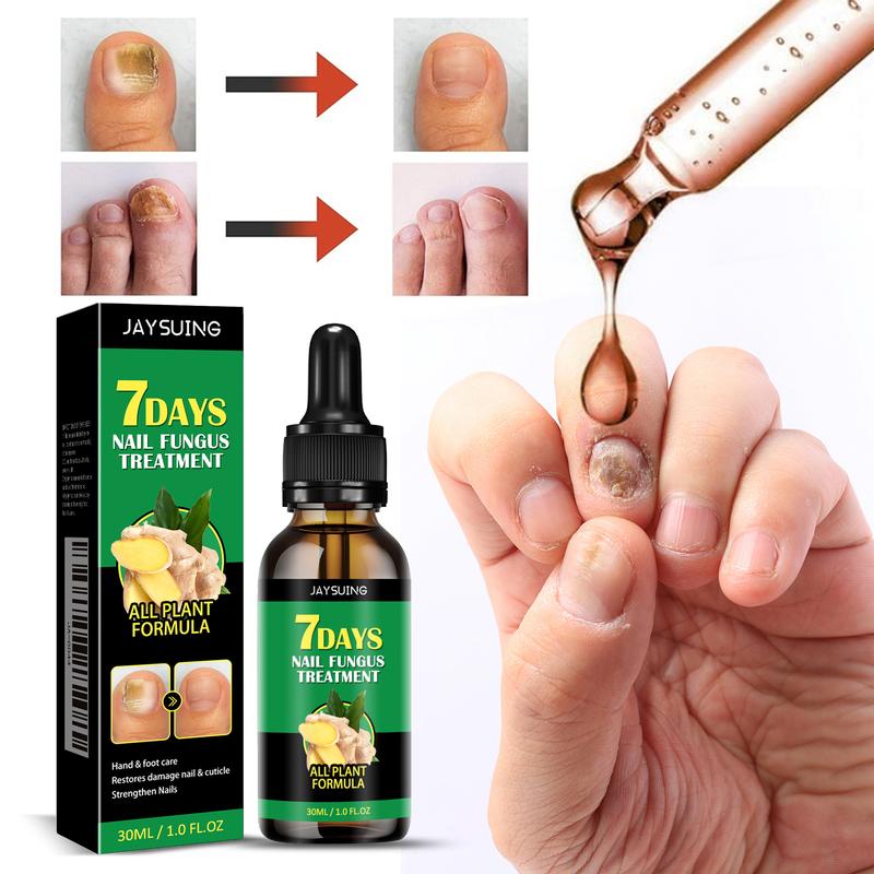 7 Days Miracle Ginger Nail Treatment Essence Oil - Ultimate Solution for Damaged & Discolored Nails. Revitalize Your Nails with Nourishing Support, Ideal for Manicure Enthusiasts. Repair, Renew & Beautify Your Nails with Comforting Care & Artistic Polish