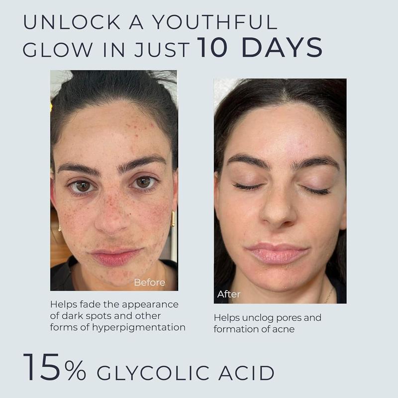 15% Aha Glycolic Acid  And Lactice Acid Serum for Face - Skin Repair and Brightner Skincare  Facial Treatment Acne Facial Radiance Tea Tree Comfort