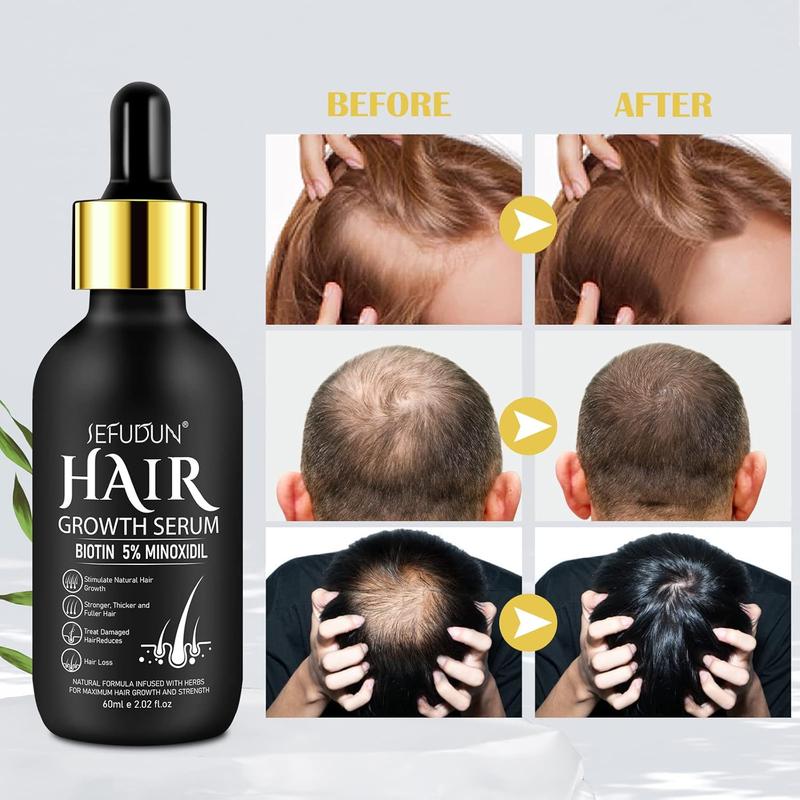 5% Minoxidil Hair Growth Serum for Men & Women, Biotin Hair Regrowth Treatment, Thicker, Healthier Hair, 2.02 oz