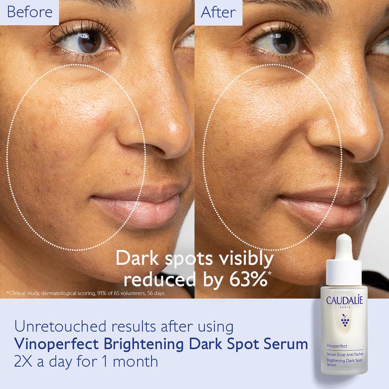 Vinoperfect Brightening Dark Spot Serum Vitamin C Alternative Skincare Comfort