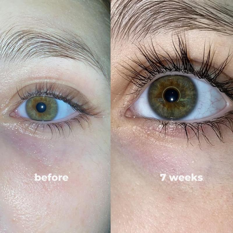 nuorganic eyeLash Growth Serum - Thicker + Longer + Stronger Eye Lashes in 30 Days - Natural + Vegan + Cruelty Free - As Seen on Tiktok! Extra Large Bottle + 3 Month Supply - 0.3 fl Oz   8ml