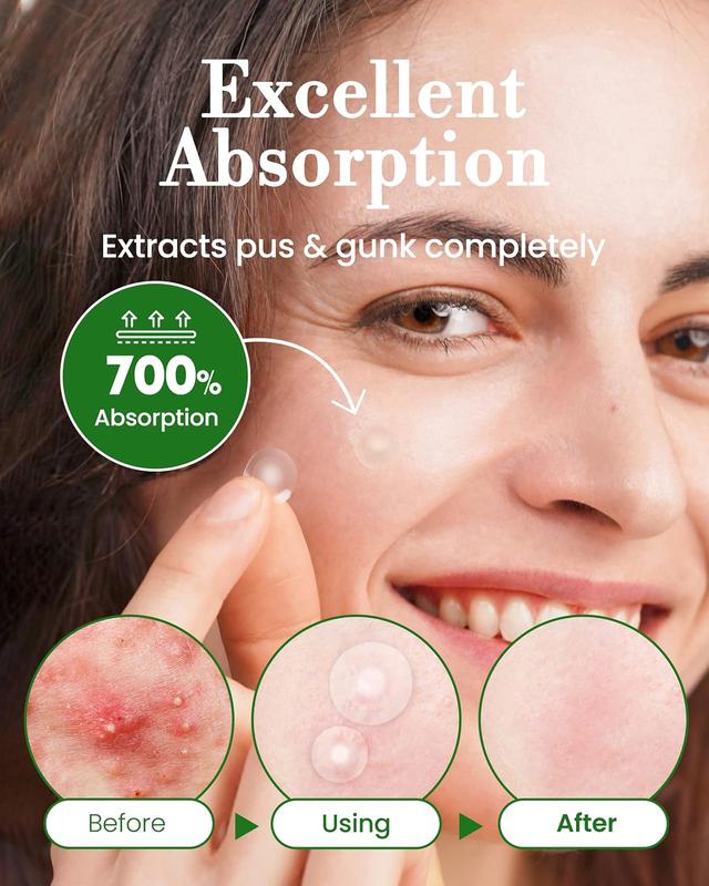 Troubless Invisible Pimple Spot Patch - 96 Ultra Thin Acne Patches - Easy Peel - 2 Sizes Skincare Skin Repair