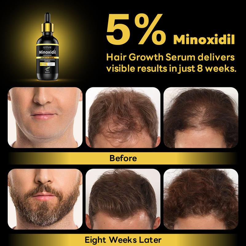 GFTNAT 5% Minoxidil Oil for Hair & Beard-60ml, Hair Care