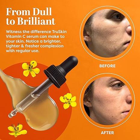 VGO-Vitamin C Facial Serum Essence, Skincare Cleanser-B3 Gentle Moisturize Skin Repair