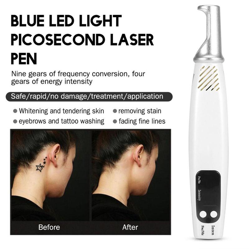 Blue Lighting Spot Remover Pen, Adjust The Strength of The Electric Spot Remover Pen to Reduce Freckles Portable Melanin Decomposition Remove Black Spots for a (US Plug) Facial Comfort