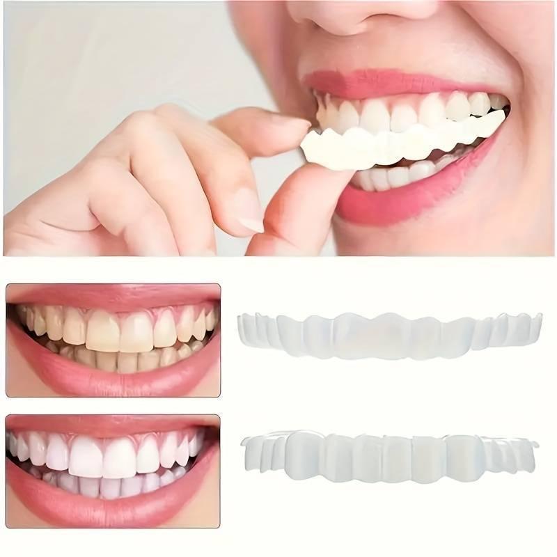 1 Pair SmileShield Cosmetic Veneers - Invisible Teeth Gap and Stain Cover, Confidence Boosting Snap-On Teeth Covers, Easy to Use Plastic Dental Veneers for Yellow Spots and Buckteeth Correction