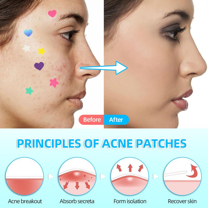 Pimple Patch for face, 2 sizes  Star Patch (240pcs) and Love Patch (216pcs)，Hydrocolloid Acne Patches，Witch Hazel Extract & Tea Tree Oil ， Skincare Skin Repair