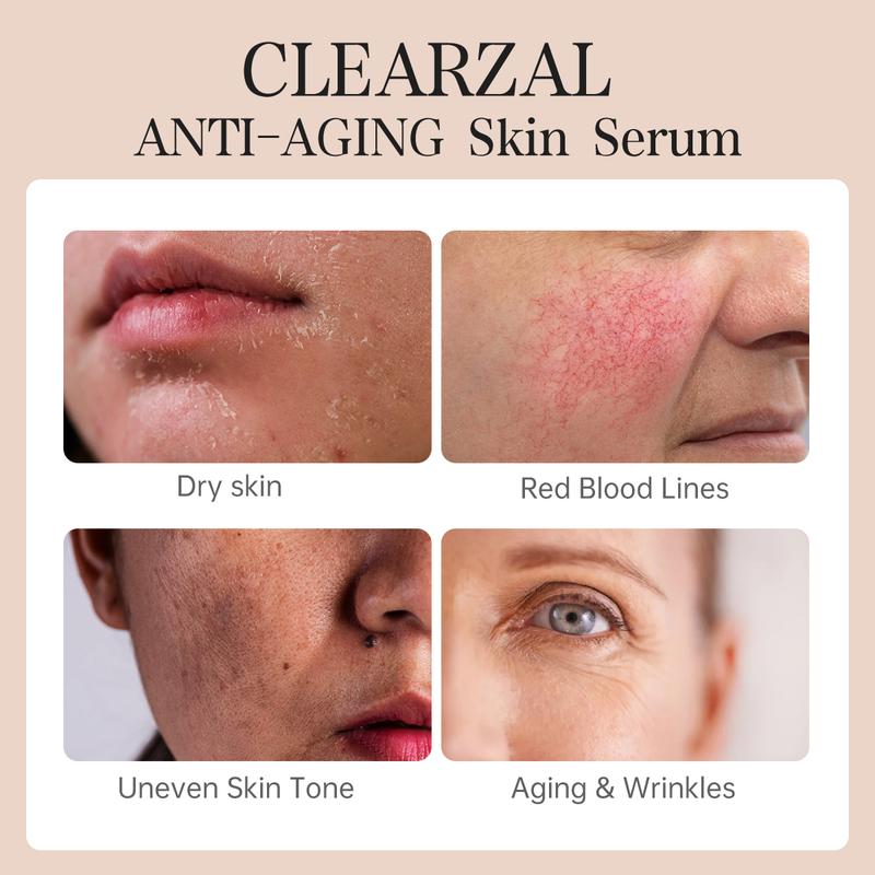 CLEARZAL Anti-Aging All Natural Skin Serum Moisture Embracing Formula with Essential Oils, 4 ounces help relieve irritation, dryness and flakiness.Non-Greasy，helps reinforce skin’s natural defenses, soothe redness, and restore elasticity and suppleness