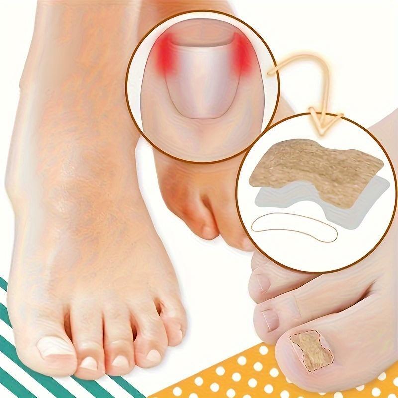 Toenail Lift Patch Set (100pcs set), Ingrown Toenail Lift Patches & Nail Collector, Manicure & Pedicure Tool for Women & Men