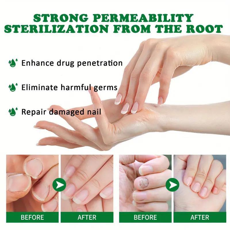 (Free Shipping) JAYSUING Ginger Nail Treatment Support Nail Care with Vitamin E and Plant Essential Oils- toes  nail paronychia beriberi Onychomycosis Nail deformation. Comfort Nail Polish Manicure Nail Art