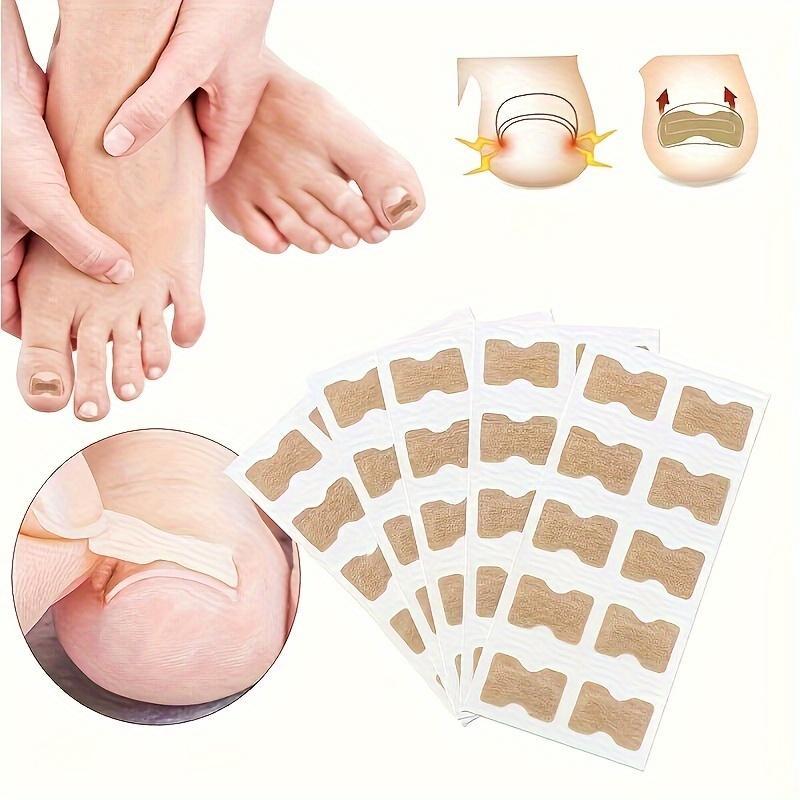 Toenail Lift Patch Set (100pcs set), Ingrown Toenail Lift Patches & Nail Collector, Manicure & Pedicure Tool for Women & Men