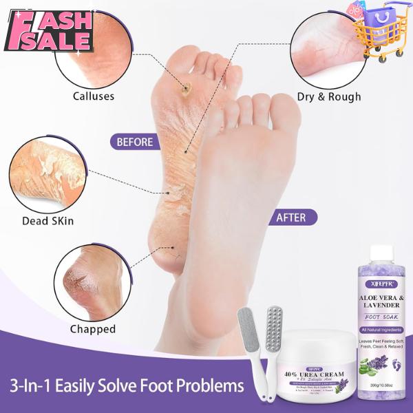 Foot Soak Set Callus Remover Pedicure Kit - Urea Cream 40%, Lavender Foot Soak Salt with Epsom Salt & Foot File for Dead Skin, Foot Care Kit for Dry Cracked Heels