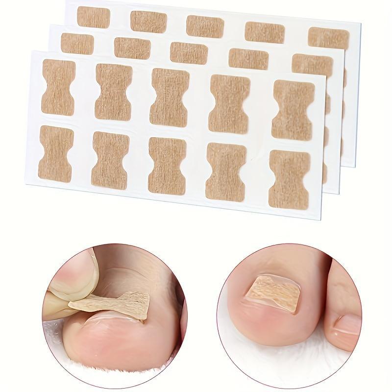 Toenail Lift Patch Set (100pcs set), Ingrown Toenail Lift Patches & Nail Collector, Manicure & Pedicure Tool for Women & Men