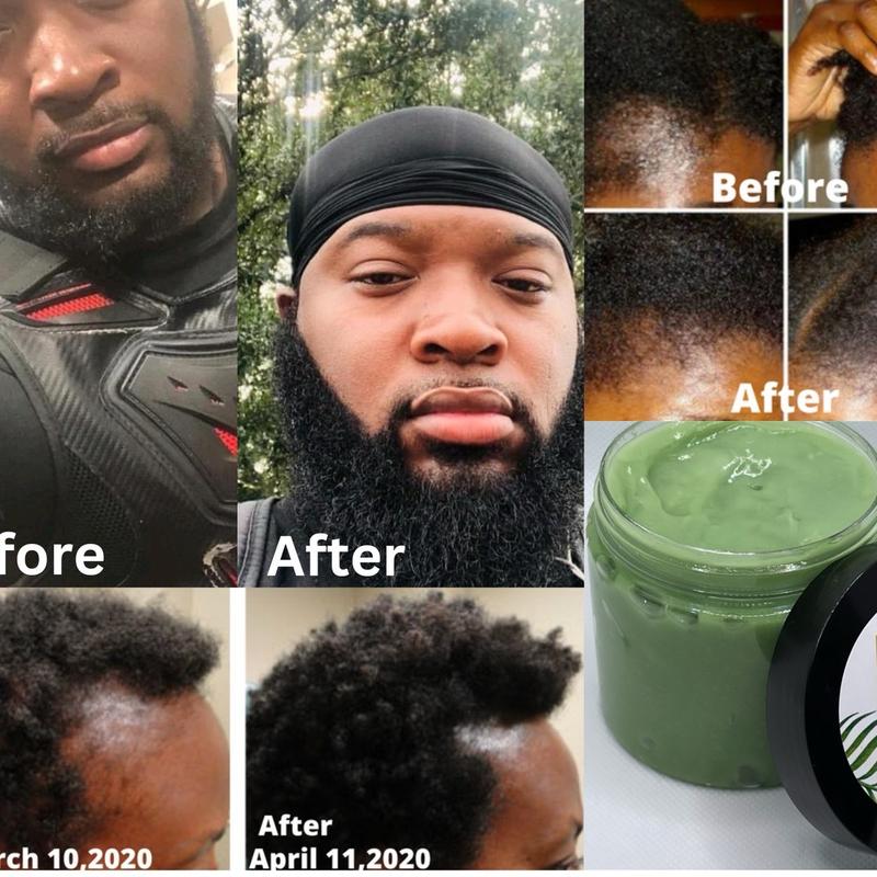 Superior growth grease, all natural hair grease,aloe Vera hair grease, hair growth grease, hair moisturizer, hair growth, thick hair Organic Anti-dandruff, Haircare