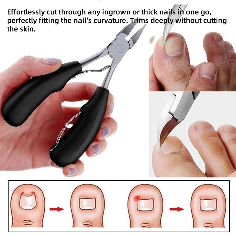 Introducing the Eagle Beak Nail Clipper! Specifically designed for those suffering from ingrown nails and thick, painful nails due to paronychia.