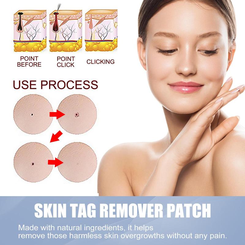 Skin Tag Remover Patches, 2 Boxes Acne Patches, Hydrocolloid Acne Patches, Skin Care Products for Women & Men, Acne Treatments, Christmas Gift