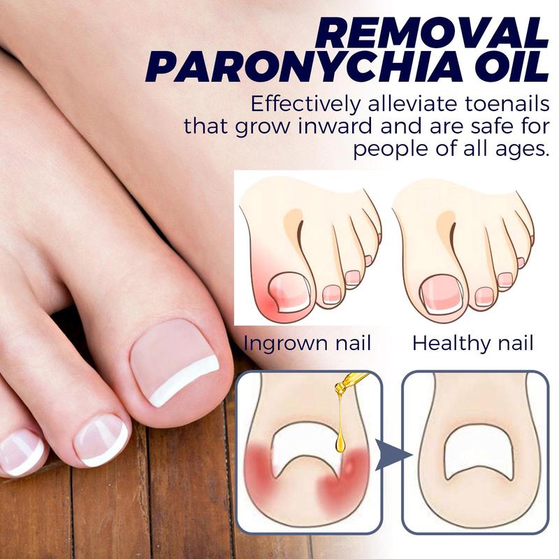 Toenailcare Removal Paronychia Oil,Toenail Treatment Best Nail Repair Solution, Anti Paronychia Relief Oil for Toenail Care.