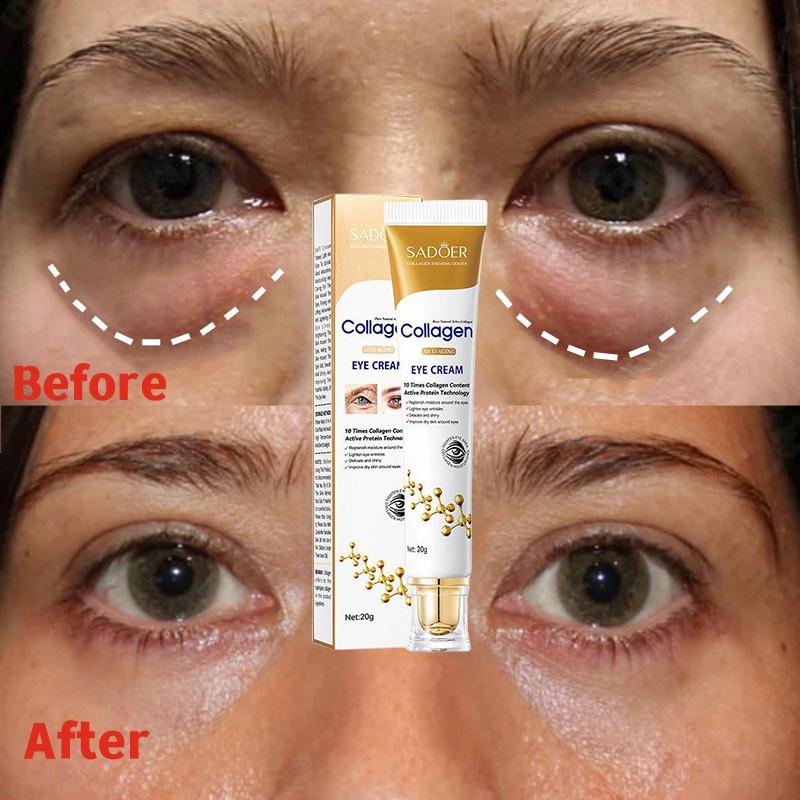 Instant Eye Bag Removal Cream Collagen Removal Wrinkles Firming Skin Fade Fine Lines Brighten Dark Circle Anti Puffiness 2024