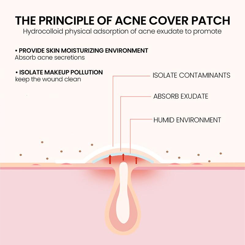 JAYSUING Star Shaped Acne Patch 200pcs Lighten Acne Spots Repair Skin Acne Scars Cover Blemishes Blackheads