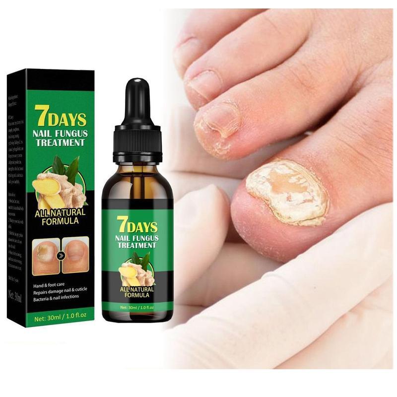 Ginger Nail Treatment for Dry and Brittle Nails - Antibacterial Daily Support